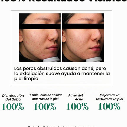 AHA BHA PHA 30 Days Miracle Toner – 150 Ml – Tónico Exfoliante Facial Coreano Con Ácido Salicílico – Cuidado Diario De Poros Y Control De Grasa Con 2% De Niacinamida