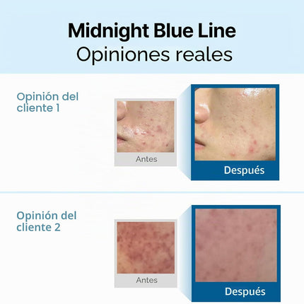 Dearklairs Crema Calmante Azul Medianoche, Para Pieles Grasas, Problemáticas Y Sensibles, Calma Y Calma Rápidamente La Sensibilidad (2 Onzas (Paquete De 1))