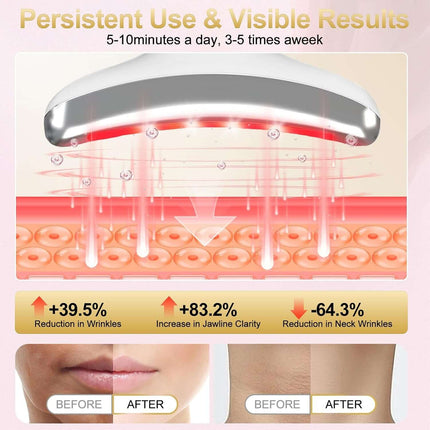 Masajeador Facial LED Antiarrugas — Vibración, Calor y Frío