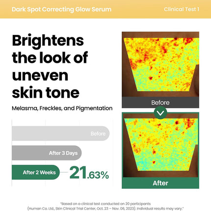 Suero Iluminador Corrector De Manchas Oscuras Eliminador De Manchas Oscuras Con 5% De Niacinamida Para El Rostro. Cuidado De La Piel Vegano Coreano. 50 Ml.