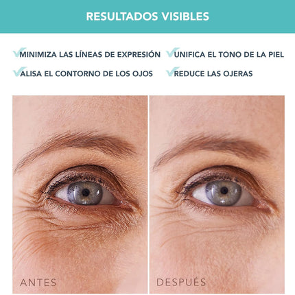 FOREO IRIS Parches Ojos Com Colageno - Contorno De Ojos Antiojeras - Vitamina B, Vitamina C Y Vitamina E - Retinol - Antiojeras Mujer - Hidratante - Vegano - 60 Parches Ojos Bolsas Y Ojeras