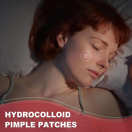 Parches Anti-Granos Hidrocoloide (216 Uds)