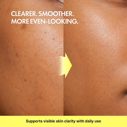 TIAM Vita B3 Source Serum, Niacinamide 10% + Arbutin 2%, Charming Tone Maker Tone-Balancing Treatment for Uneven Skin Tone, Dark Spot Care & Skin Clarity, Lightweight Daily Facial Formula, 1.35 Fl Oz