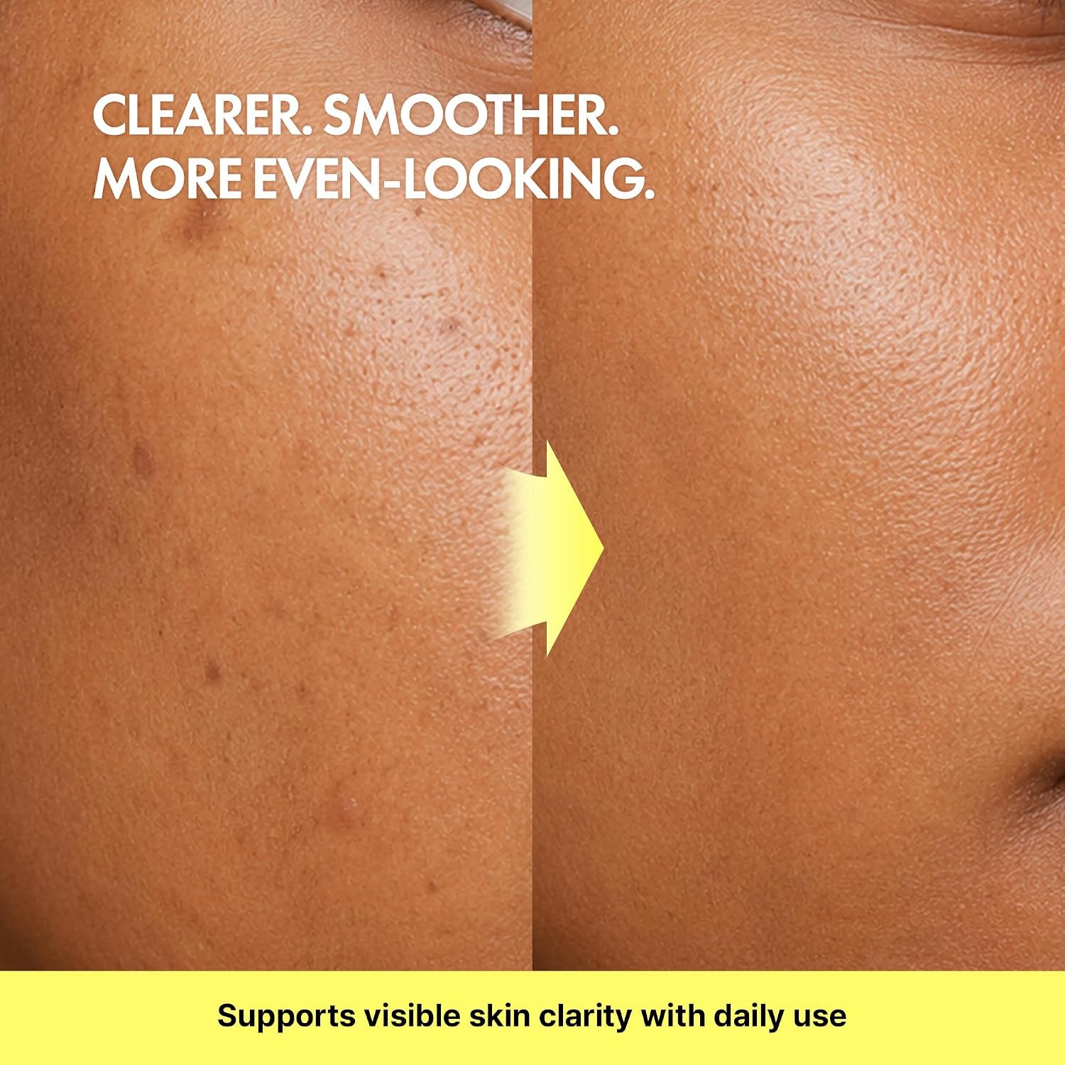 TIAM Vita B3 Source Serum, Niacinamide 10% + Arbutin 2%, Charming Tone Maker Tone-Balancing Treatment for Uneven Skin Tone, Dark Spot Care & Skin Clarity, Lightweight Daily Facial Formula, 1.35 Fl Oz
