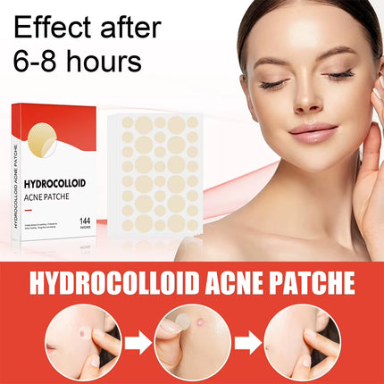 144Pcs/Set Face Skin Care Acne Pimple Patch 2 Sizes Invisible Professional Healing Absorbing Spot Sticker Covering for Men Women