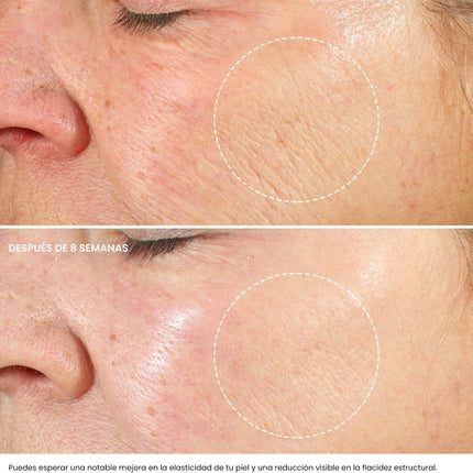 Crema Hidratante Facial Mujer Y Hombres Con Retinol, Ácido Hialurónico Y Vitamina E– Crema Antiarrugas Mujer Para Reducir Arrugas, Líneas Finas Y Manchas Oscuras – Antiedad Facial Crema De Noche -50Ml