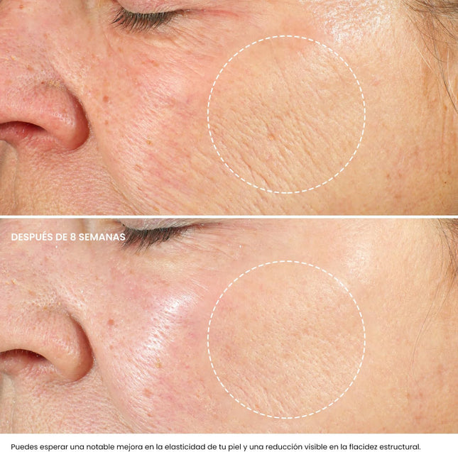 Crema Hidratante Facial Mujer Y Hombres Con Retinol, Ácido Hialurónico Y Vitamina E– Crema Antiarrugas Mujer Para Reducir Arrugas, Líneas Finas Y Manchas Oscuras – Antiedad Facial Crema De Noche -50Ml