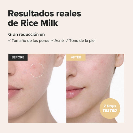 Beauty of Joseon Tónico Facial Hidratante Y Revitalizante Con Arroz Para Pieles Mixtas Y Grasas, Cuidado Coreano Hidratante Y Equilibrado, 150 Ml (5,07 Fl Oz)