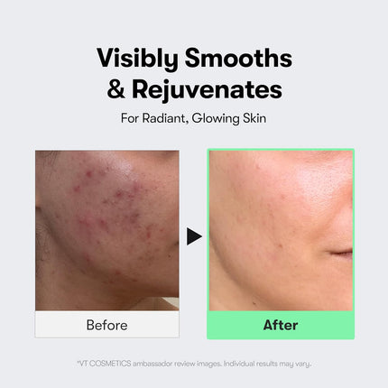 CICA Reedle Shot 100, Spicule Microneedling Serum for Pore Care & Exfoliation, Exosome, Centella Asiatica for Glass Skin, Skin Texture, Korean Liquid Skin Booster (1.69 Fl Oz / 50Ml)