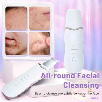 Espatula Ultrasonica Facial para Limpieza y Peeling