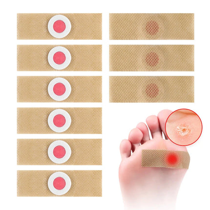 6PCS Foot Care Sticker Patch Removal Pads Curative Patches Calluses Remove Callosity Detox Summer Foot Care Tools