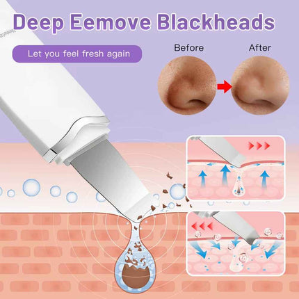 Espatula Ultrasonica Facial para Limpieza y Peeling