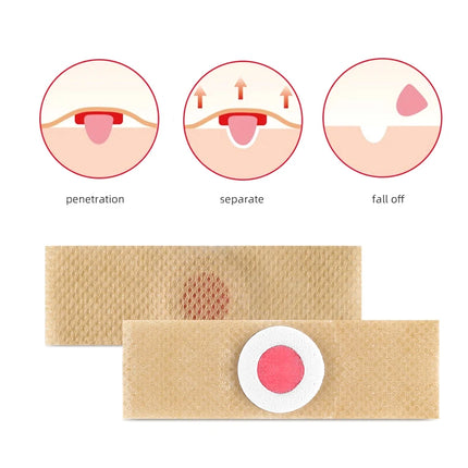6PCS Foot Care Sticker Patch Removal Pads Curative Patches Calluses Remove Callosity Detox Summer Foot Care Tools