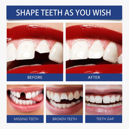 Resin Tooth Repair Glue Shapeable Teeth Gaps Filling Solid Glue Temporary Tooth Repair Safe DIY Emergency Dental Care Supplies