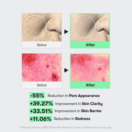 CICA Reedle Shot 100, Spicule Microneedling Serum for Pore Care & Exfoliation, Exosome, Centella Asiatica for Glass Skin, Skin Texture, Korean Liquid Skin Booster (1.69 Fl Oz / 50Ml)